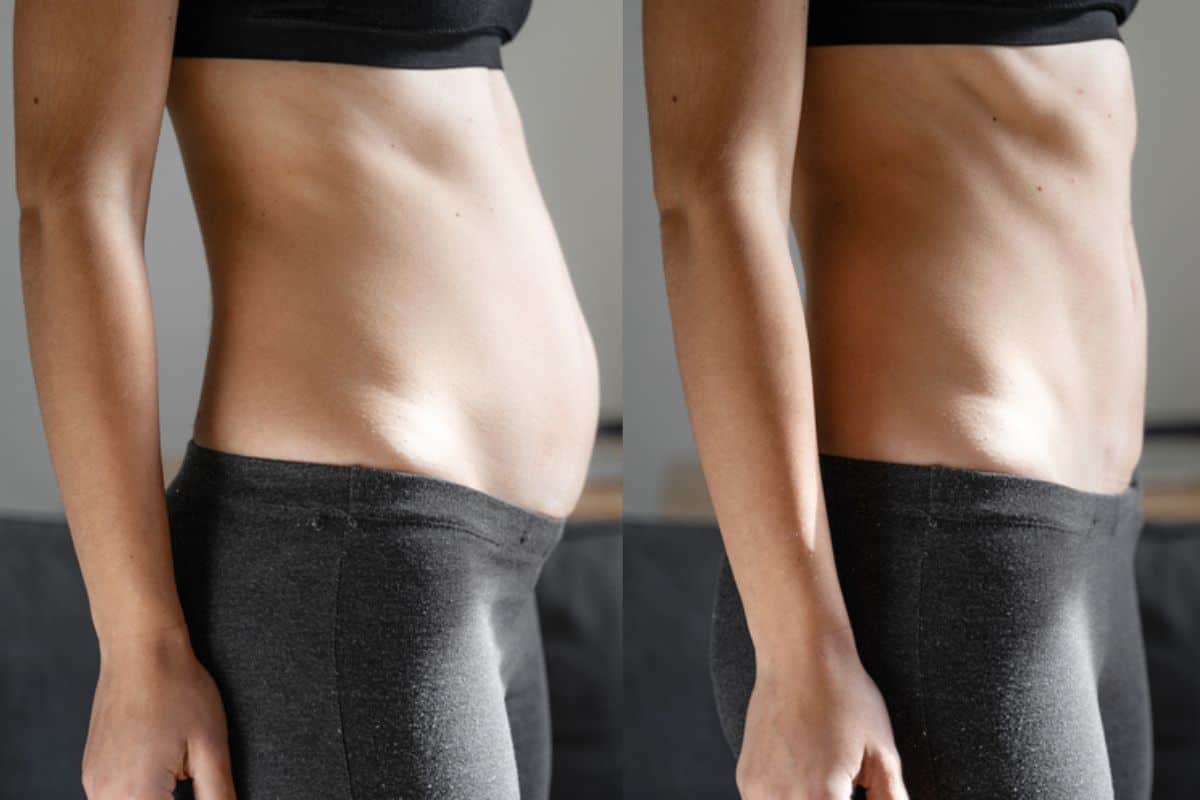 Post-Pregnancy: What Happens to Your Abdominal Muscles After Birth Greater London (City of London)