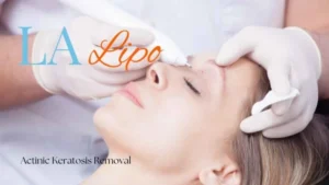 Woman receiving Actinic Keratosis Removal Treatment Greater London (City of London)