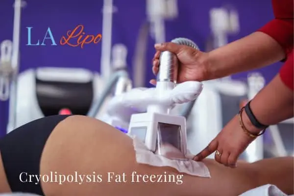 women getting fat freezing Greater London (City of London)