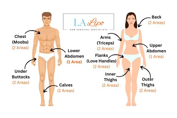 LA LIPO Cryolipolysis Areas Greater London (City of London)