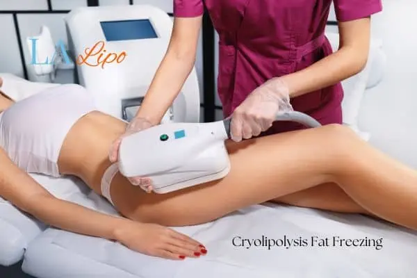 Woman receiving coolsculpting Greater London (City of London) treatment on her thighs