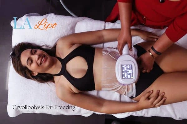 woman getting cryolipolysis Greater London (City of London)