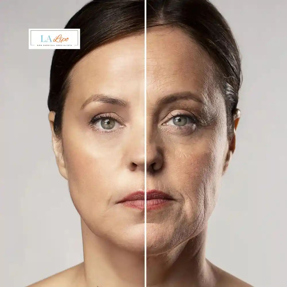 How Can You Tell If Non-Surgical Skin Tightening Is Right for You Greater London (City of London)?