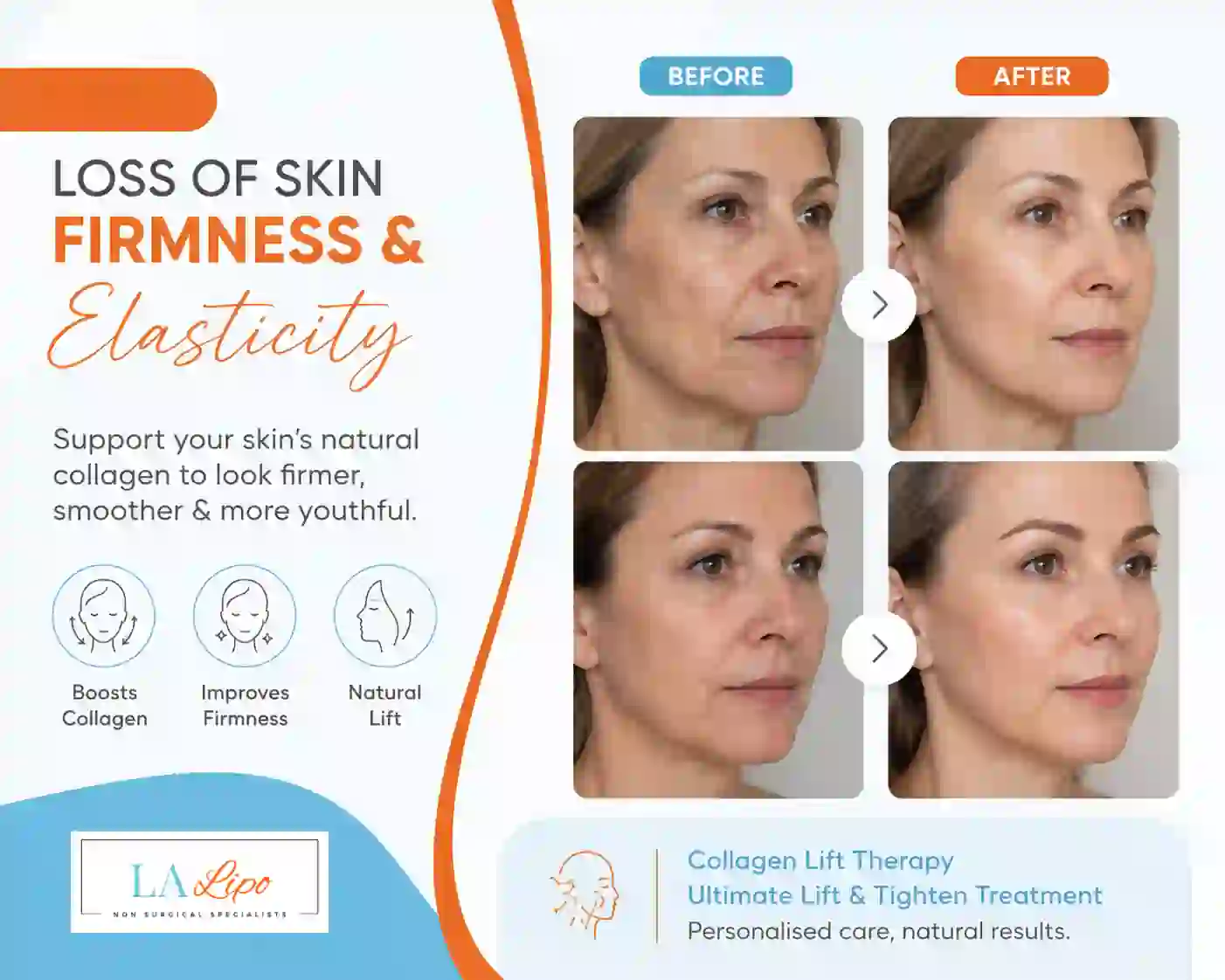 Sign #7: Loss of Skin Firmness and Elasticity Greater London (City of London)
