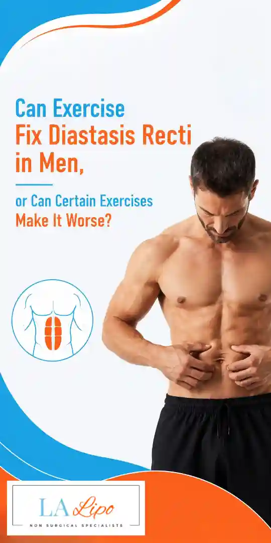 Can Exercise Fix Diastasis Recti in Men, or Can Certain Exercises Make It Worse Greater London (City of London)?